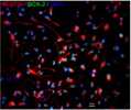 immuno