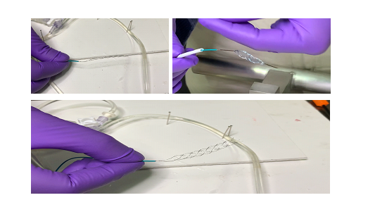 Comparison of Expansion of stent 